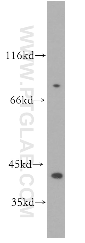 Western Blot (WB) analysis of HeLa cells using IkB Alpha Polyclonal antibody (18220-1-AP)