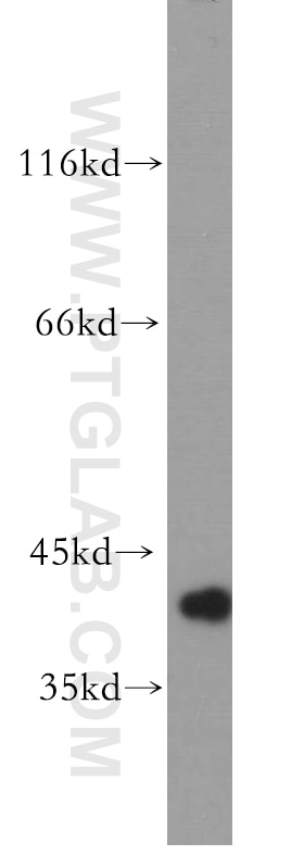 Western Blot (WB) analysis of HL-60 cells using IkB Alpha Polyclonal antibody (18220-1-AP)