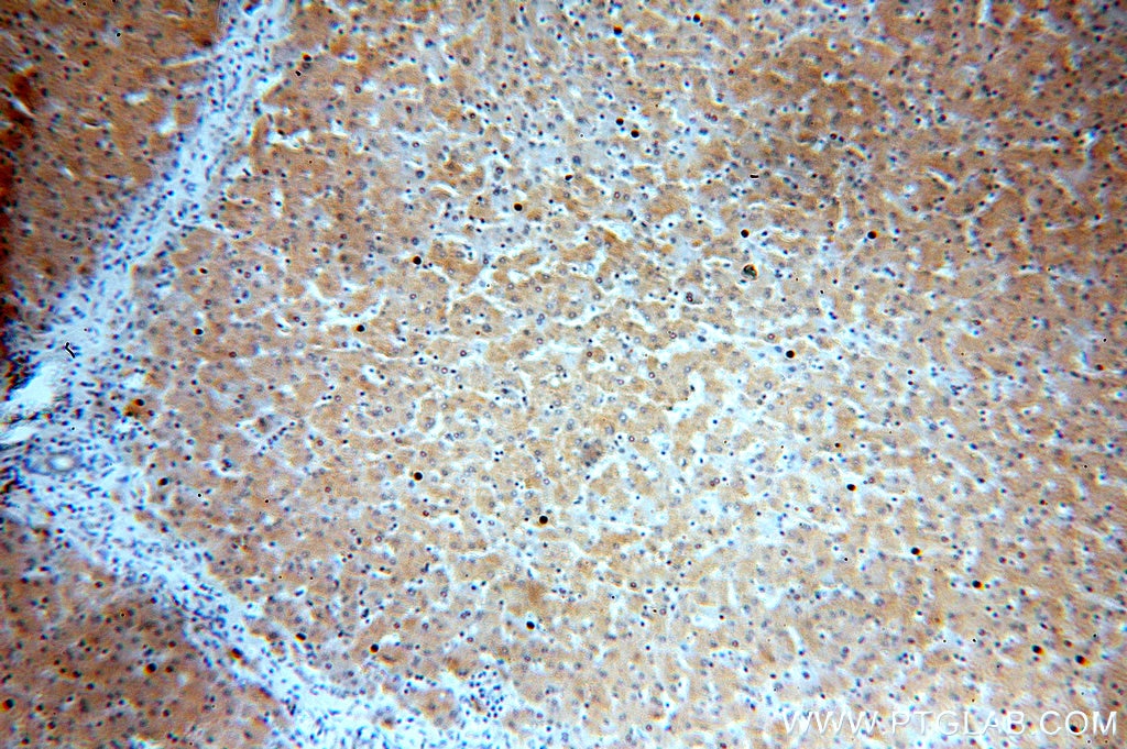 Immunohistochemistry (IHC) staining of human liver tissue using IkB Alpha Polyclonal antibody (51066-1-AP)