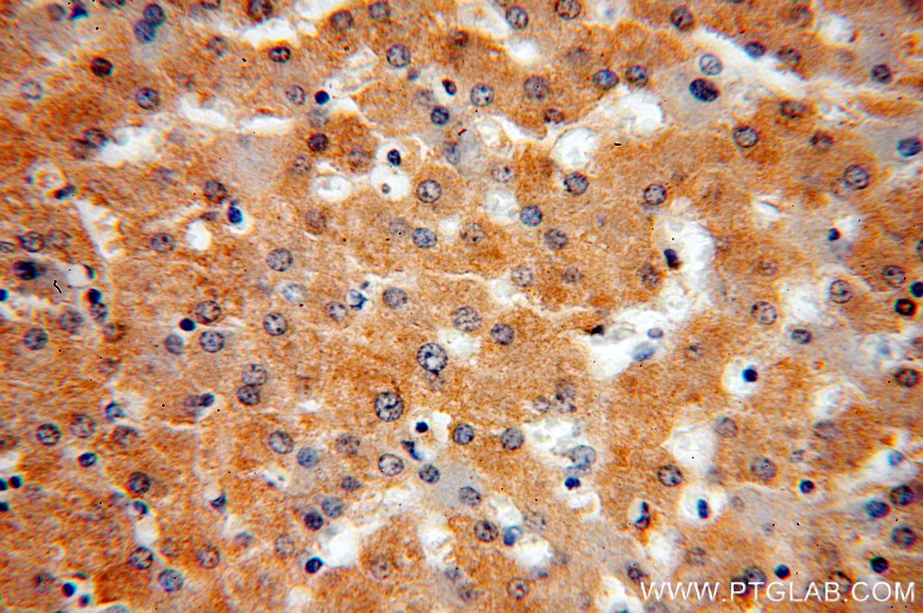 Immunohistochemistry (IHC) staining of human liver tissue using IkB Alpha Polyclonal antibody (51066-1-AP)