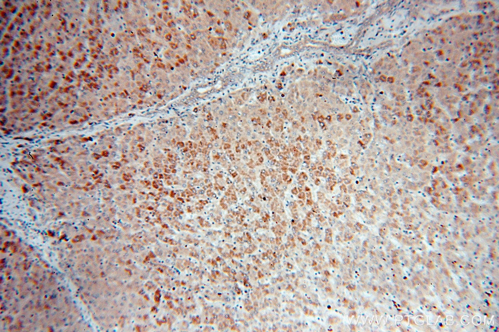 Immunohistochemistry (IHC) staining of human liver tissue using IkB Alpha Polyclonal antibody (51066-1-AP)