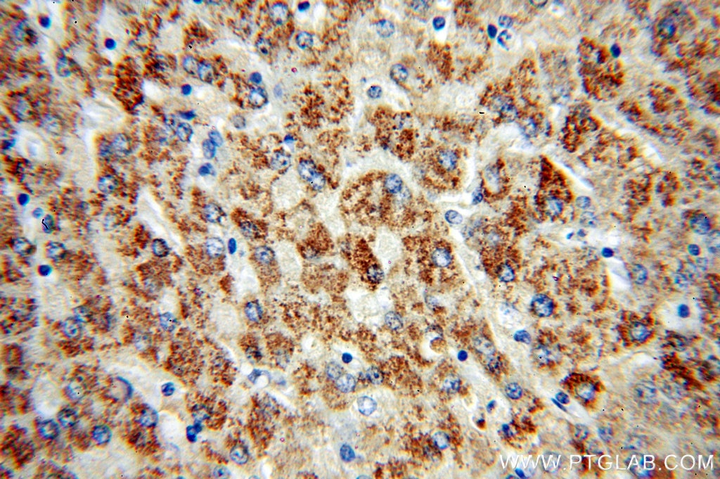 Immunohistochemistry (IHC) staining of human liver tissue using IkB Alpha Polyclonal antibody (51066-1-AP)