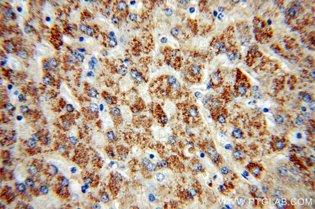 IHC staining of human liver using 51066-1-AP