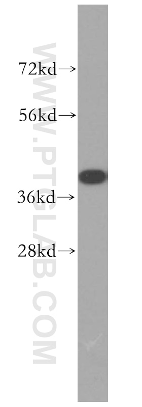 WB analysis of PC-3 using 51066-1-AP