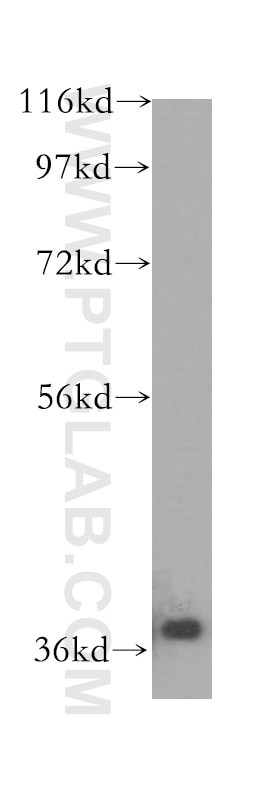 Western Blot (WB) analysis of HeLa cells using IkB Alpha Polyclonal antibody (51066-1-AP)