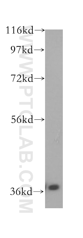 Western Blot (WB) analysis of HeLa cells using IkB Alpha Polyclonal antibody (51066-1-AP)