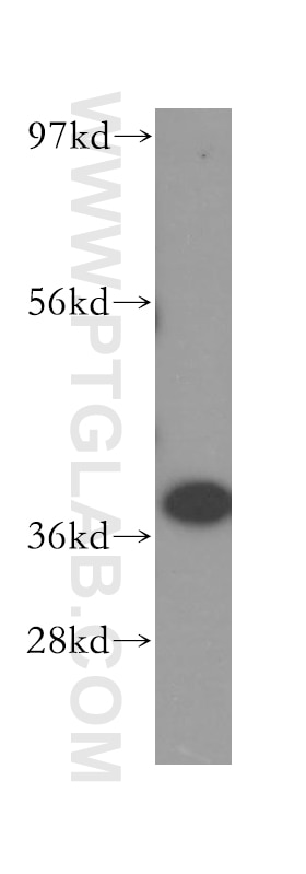 Western Blot (WB) analysis of Jurkat cells using IkB Alpha Polyclonal antibody (51066-1-AP)