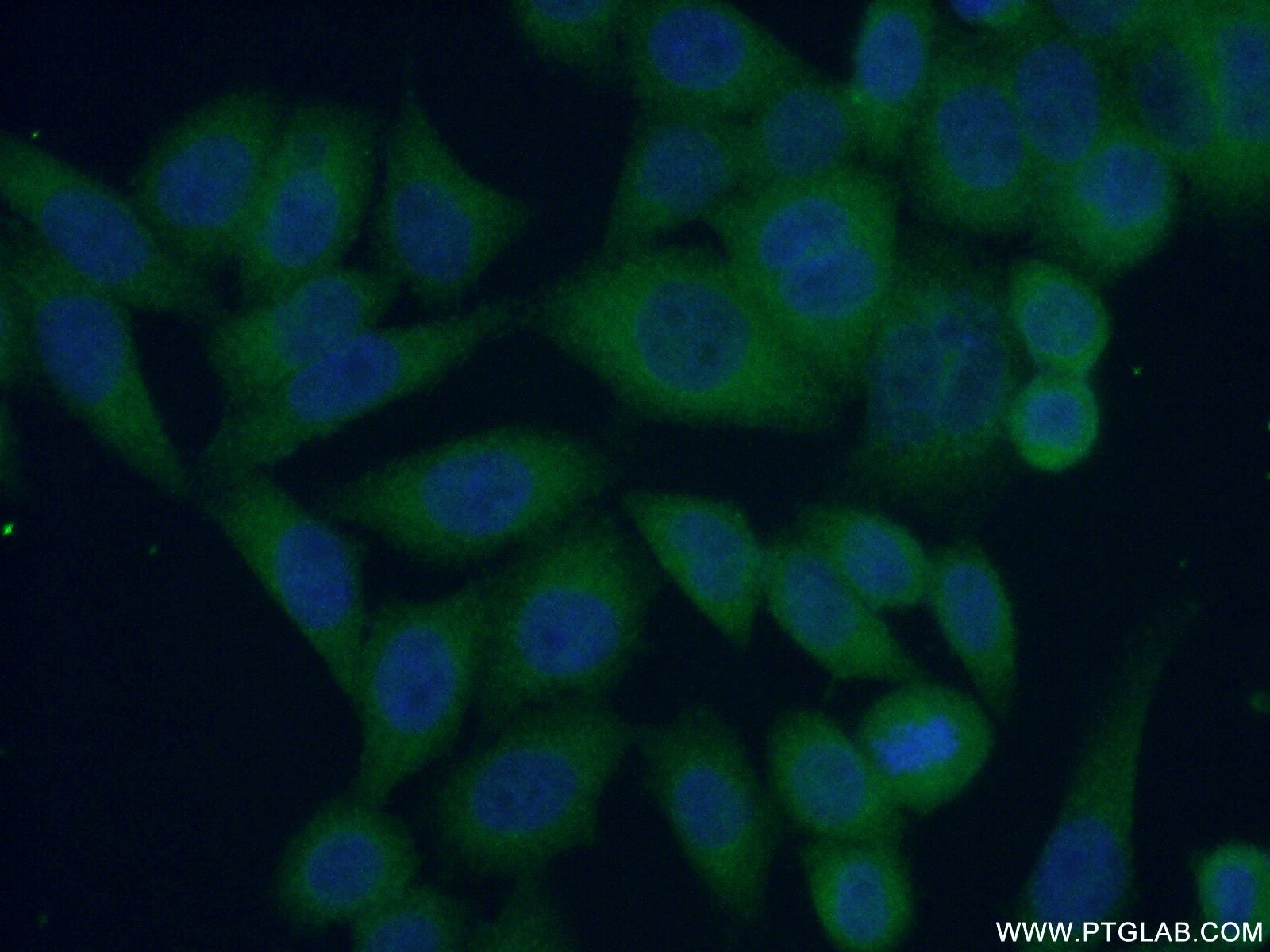 Immunofluorescence (IF) / fluorescent staining of HeLa cells using IkB Beta Polyclonal antibody (12660-1-AP)