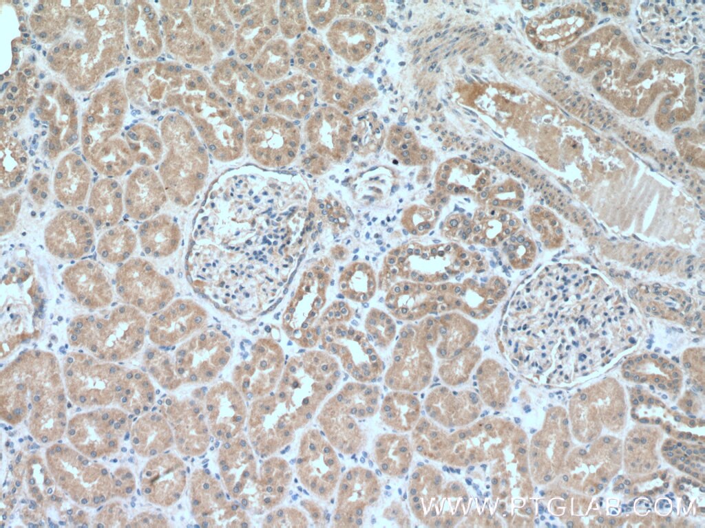 Immunohistochemistry (IHC) staining of human kidney tissue using IkB Beta Polyclonal antibody (12660-1-AP)