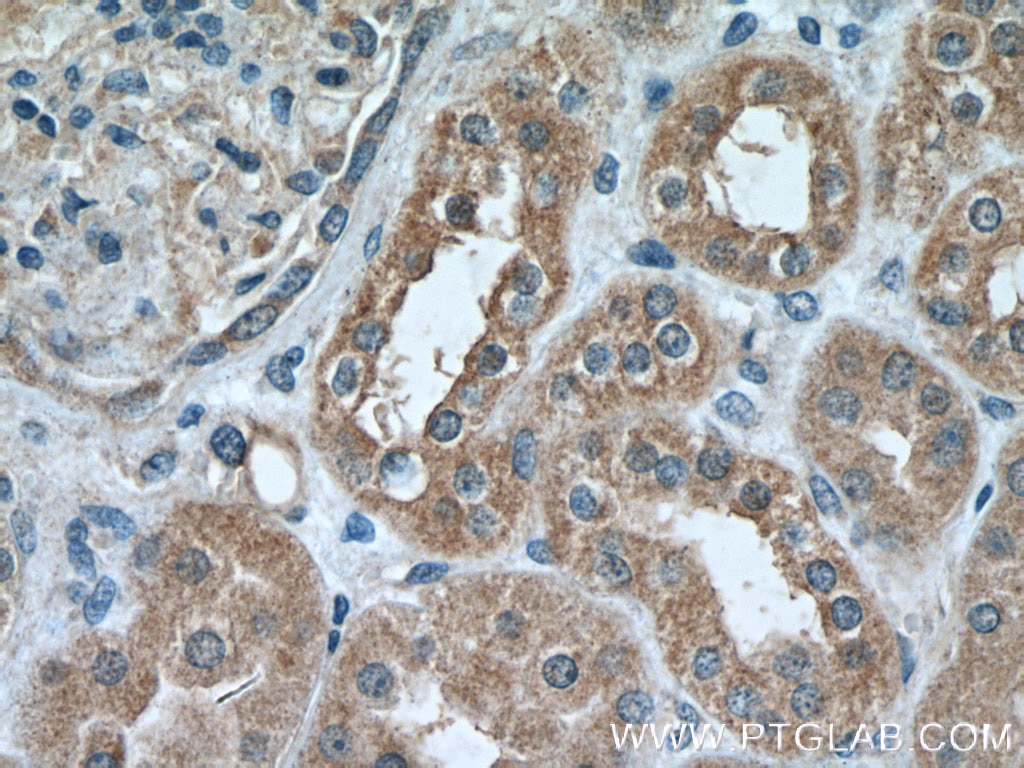 Immunohistochemistry (IHC) staining of human kidney tissue using IkB Beta Polyclonal antibody (12660-1-AP)