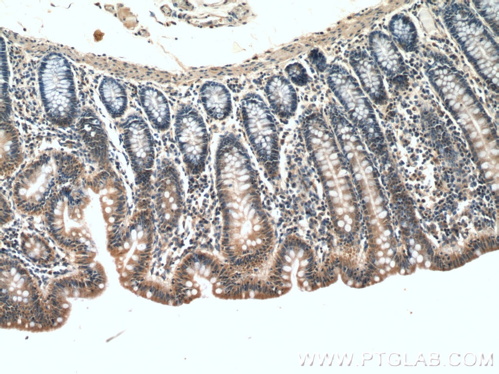 Immunohistochemistry (IHC) staining of human colon tissue using IkB Beta Polyclonal antibody (12660-1-AP)