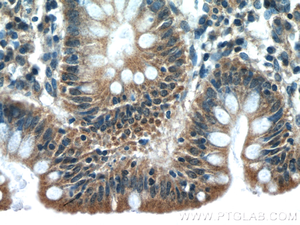 Immunohistochemistry (IHC) staining of human colon tissue using IkB Beta Polyclonal antibody (12660-1-AP)