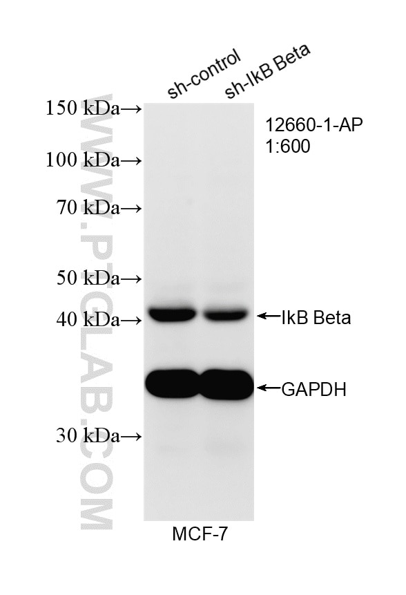 WB analysis of MCF-7 using 12660-1-AP Western Blot (WB) analysis of MCF-7 cells using IkB Beta Polyclonal antibody (12660-1-AP)