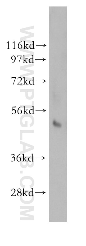 Western Blot (WB) analysis of human spleen tissue using NFKBIE Polyclonal antibody (11273-1-AP)