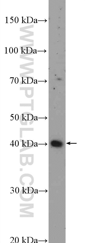 Western Blot (WB) analysis of MDA-MB-453s cells using NFKBIL1 Polyclonal antibody (26273-1-AP)