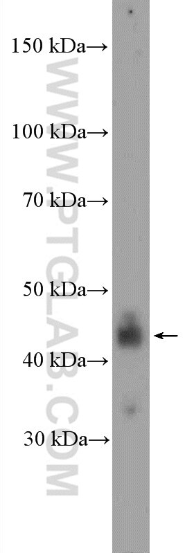 Western Blot (WB) analysis of HepG2 cells using NFKBIL1 Polyclonal antibody (26273-1-AP)