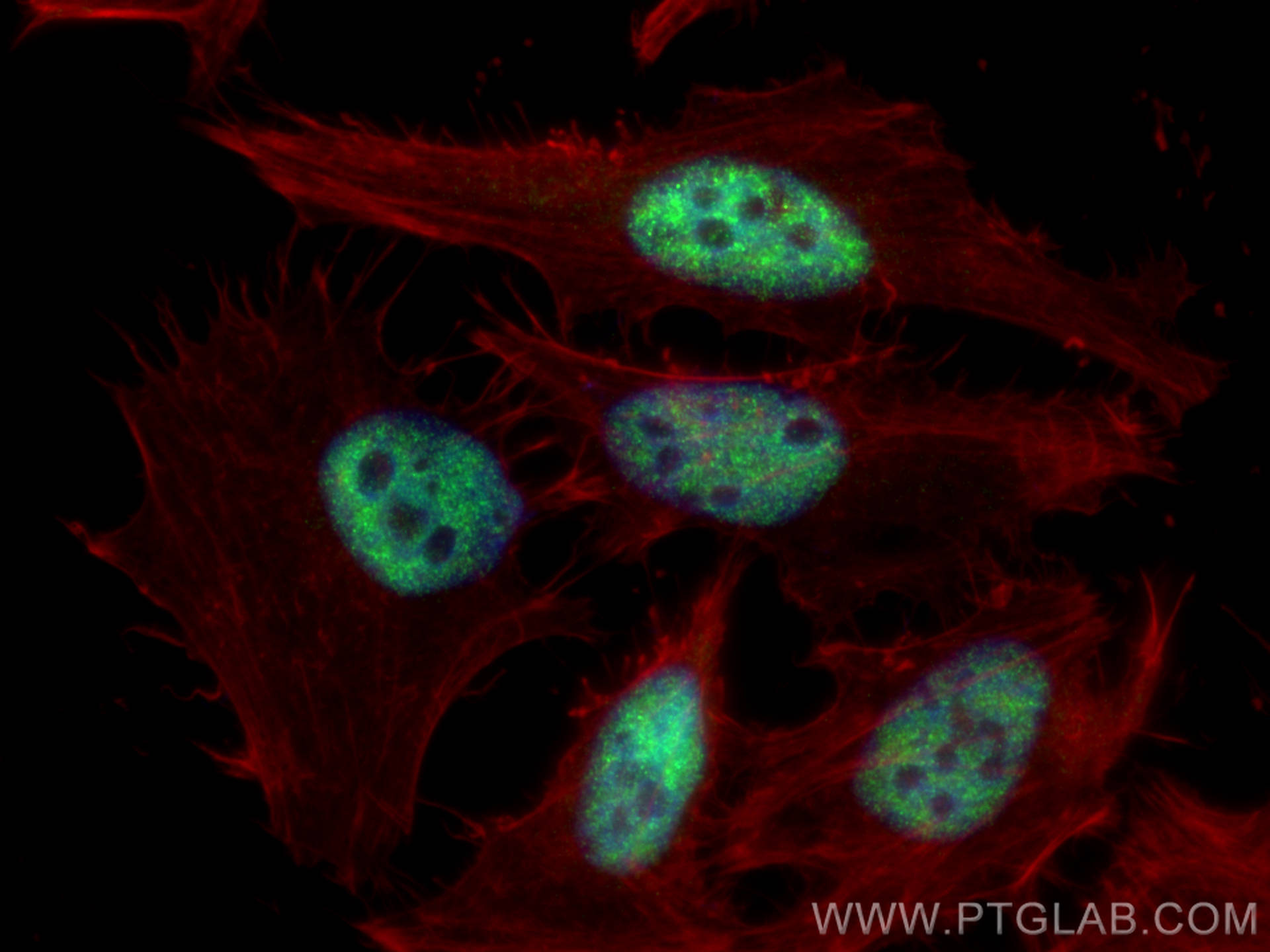 Immunofluorescence (IF) / fluorescent staining of HeLa cells using NFKBIZ Polyclonal antibody (14014-1-AP)