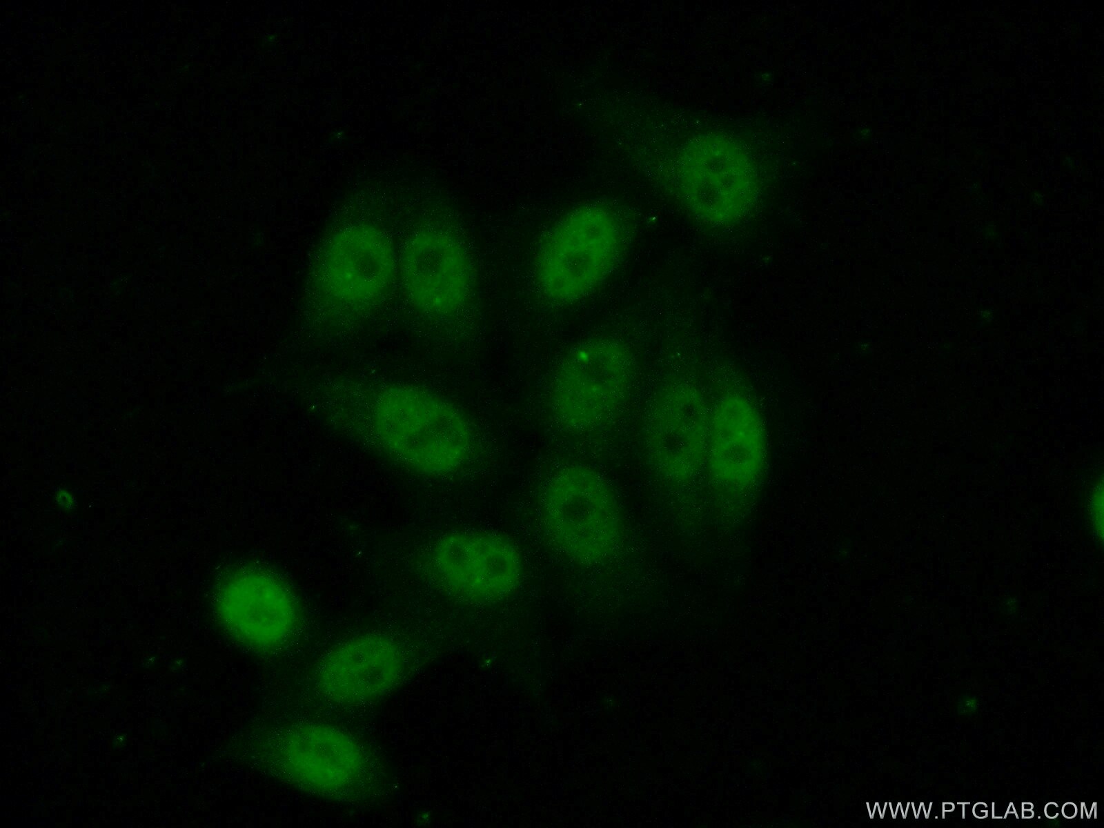 Immunofluorescence (IF) / fluorescent staining of HeLa cells using NFKBIZ Polyclonal antibody (14014-1-AP)