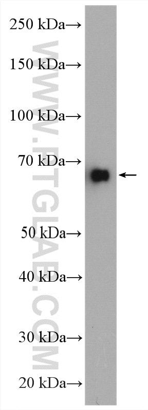 Western Blot (WB) analysis of HeLa cells using NFKBIZ Polyclonal antibody (14014-1-AP)