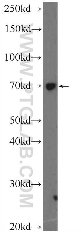 Western Blot (WB) analysis of HeLa cells using NFKBIZ Polyclonal antibody (14014-1-AP)