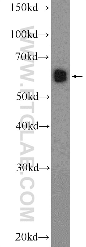 Western Blot (WB) analysis of HeLa cells using NFKBIZ Polyclonal antibody (14014-1-AP)