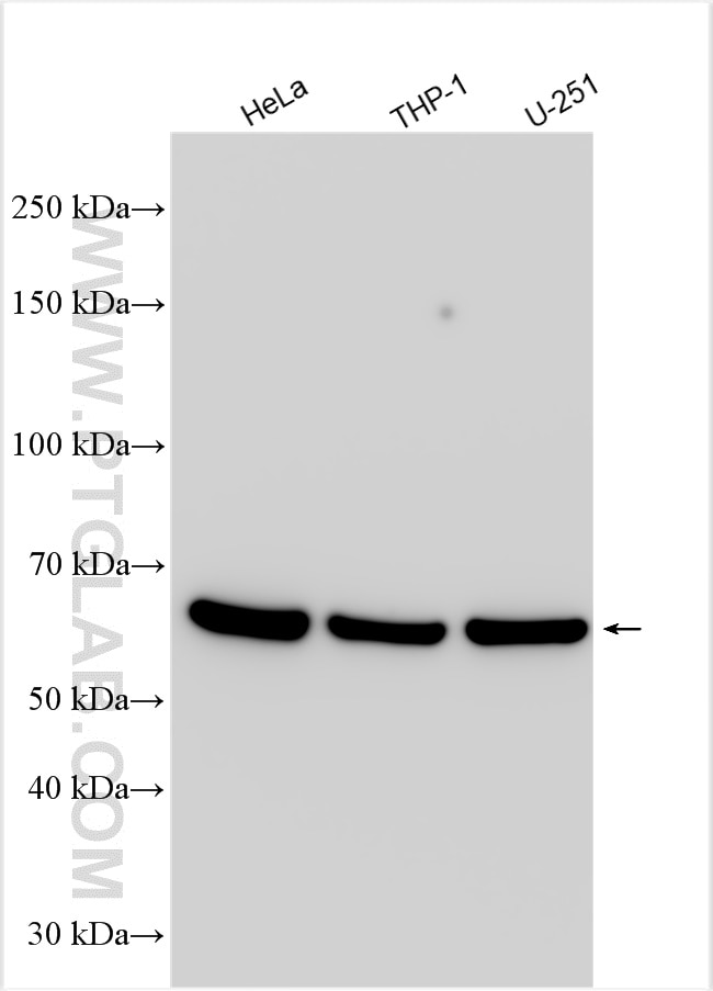 Western Blot (WB) analysis of various lysates using NFKBIZ Polyclonal antibody (14014-1-AP)