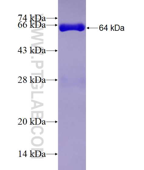 NFKBIZ fusion protein Ag5120 SDS-PAGE