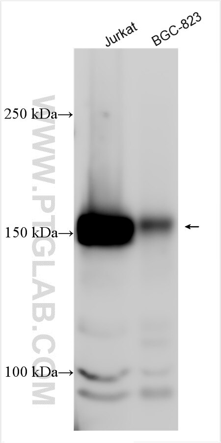 NFRKB