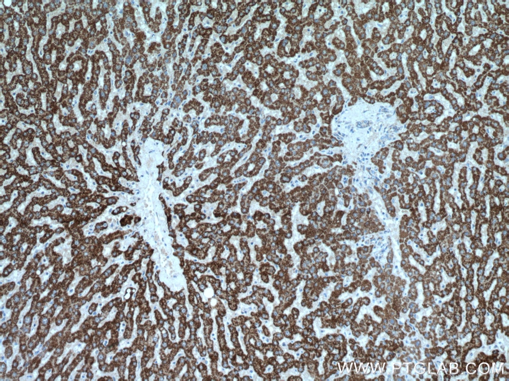 Immunohistochemistry (IHC) staining of human liver tissue using NFS1 Polyclonal antibody (15370-1-AP)