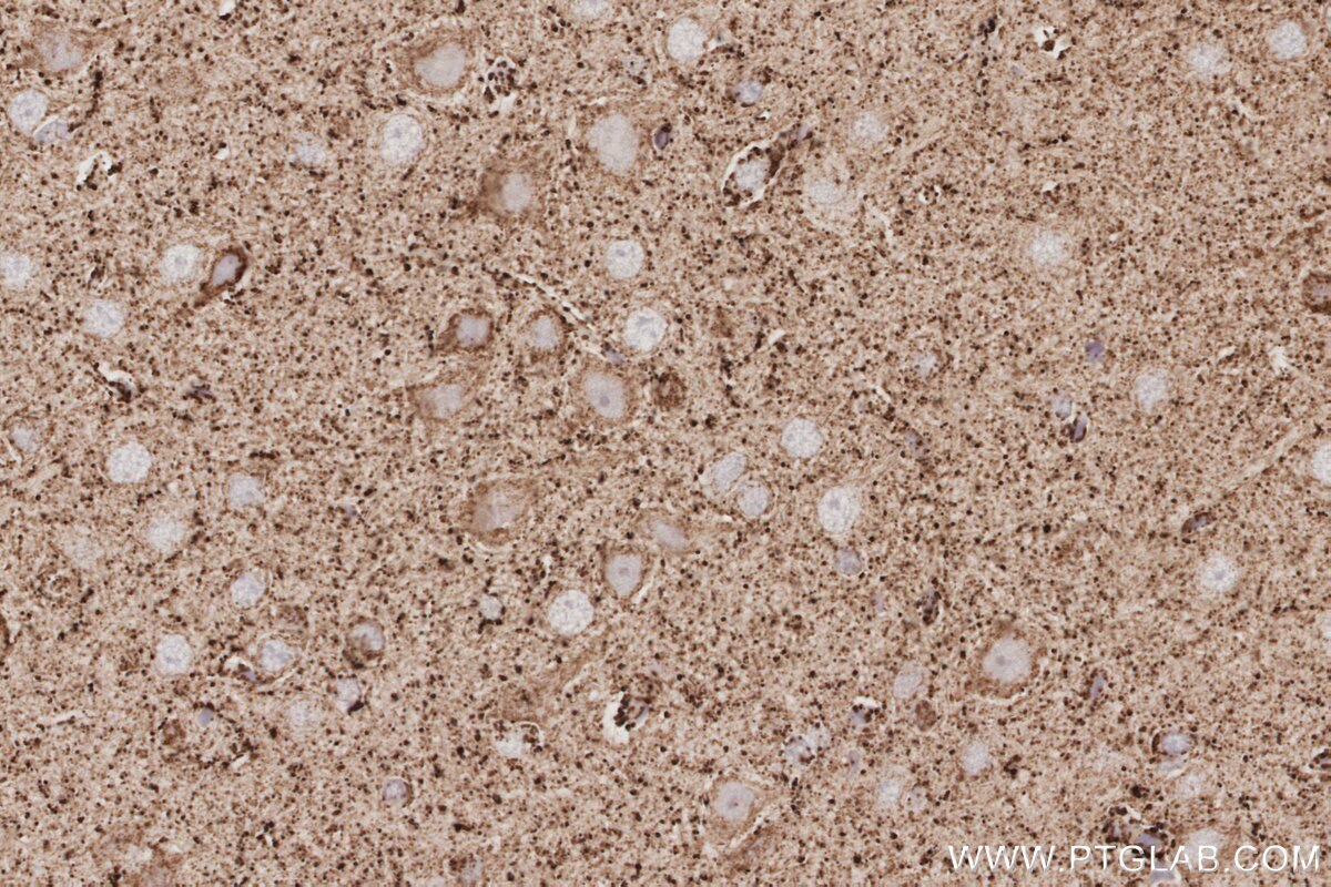 Immunohistochemistry (IHC) staining of rat brain tissue using NFS1 Polyclonal antibody (15370-1-AP)