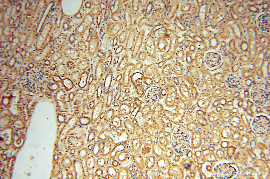 Immunohistochemistry (IHC) staining of human kidney tissue using NFS1 Polyclonal antibody (15370-1-AP)