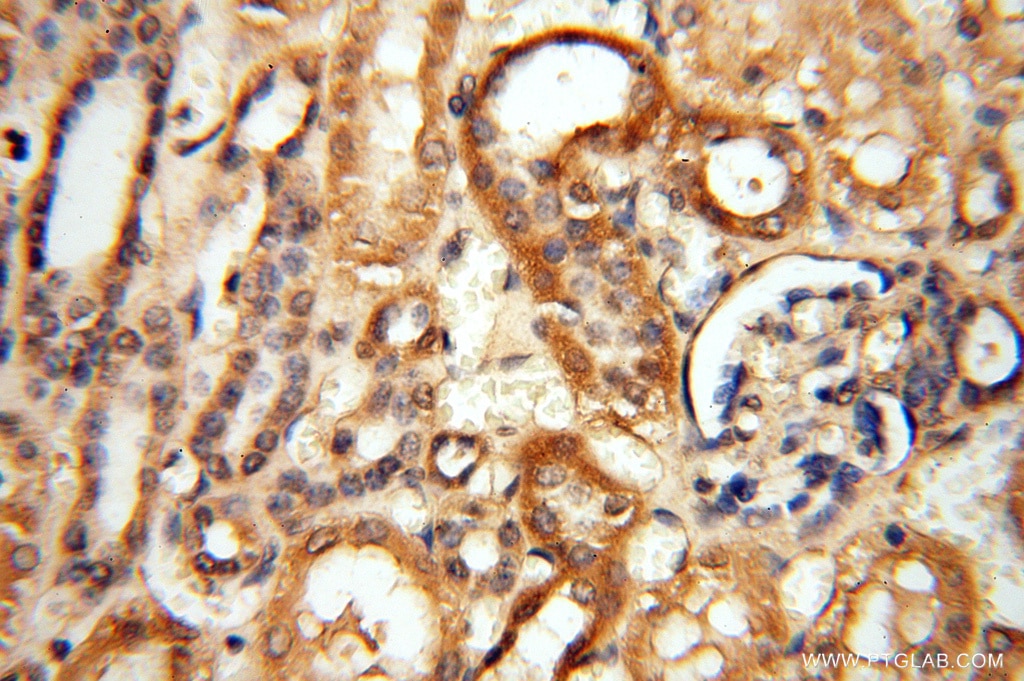 IHC staining of human kidney using 15370-1-AP