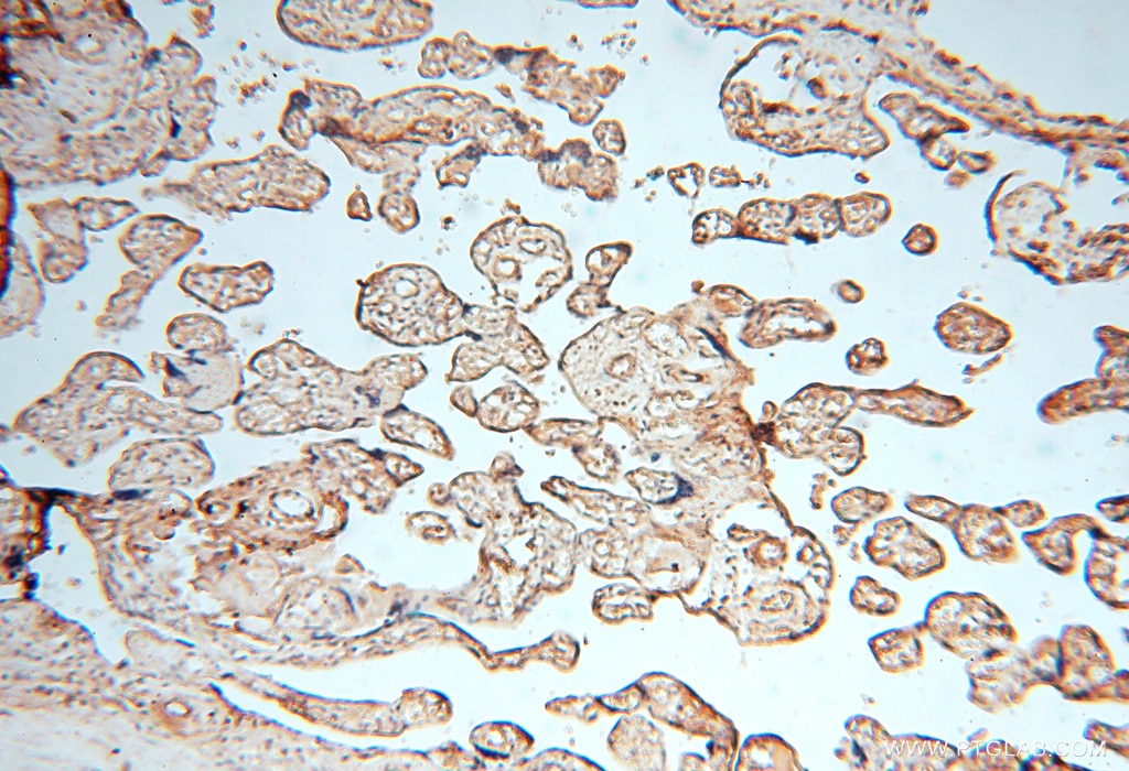 Immunohistochemistry (IHC) staining of human placenta tissue using NFS1 Polyclonal antibody (15370-1-AP)