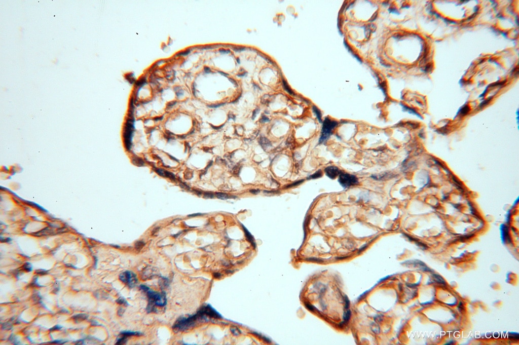 IHC staining of human placenta using 15370-1-AP