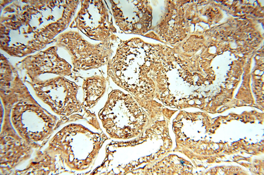 Immunohistochemistry (IHC) staining of human testis tissue using NFS1 Polyclonal antibody (15370-1-AP)