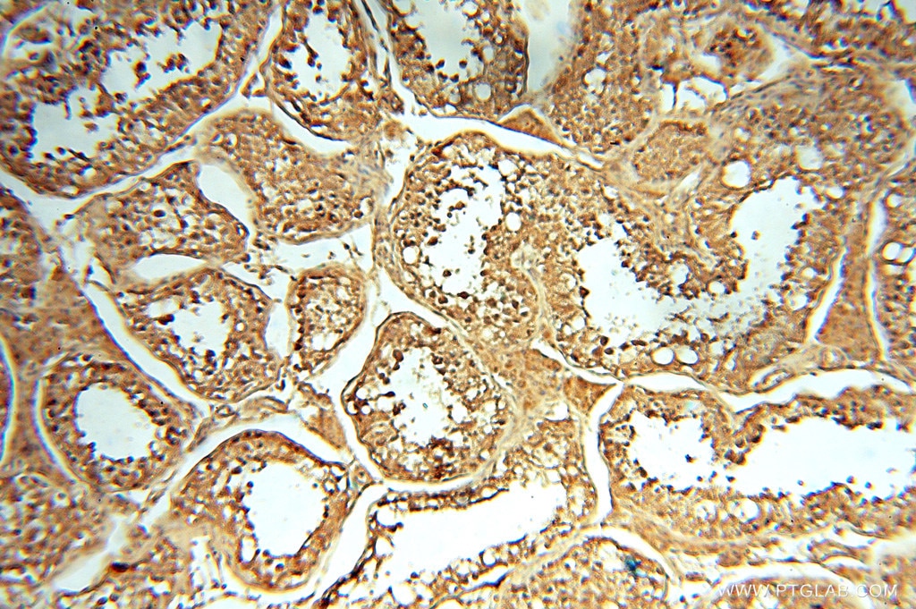 IHC staining of human testis using 15370-1-AP