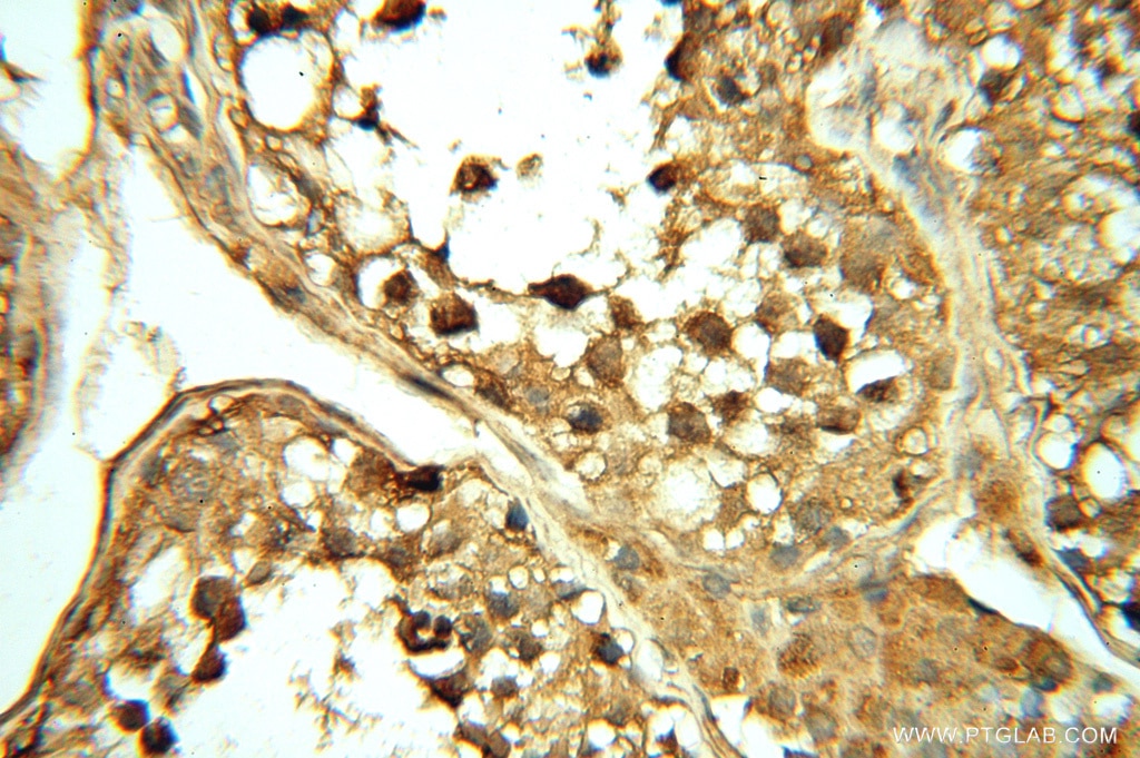 Immunohistochemistry (IHC) staining of human testis tissue using NFS1 Polyclonal antibody (15370-1-AP)