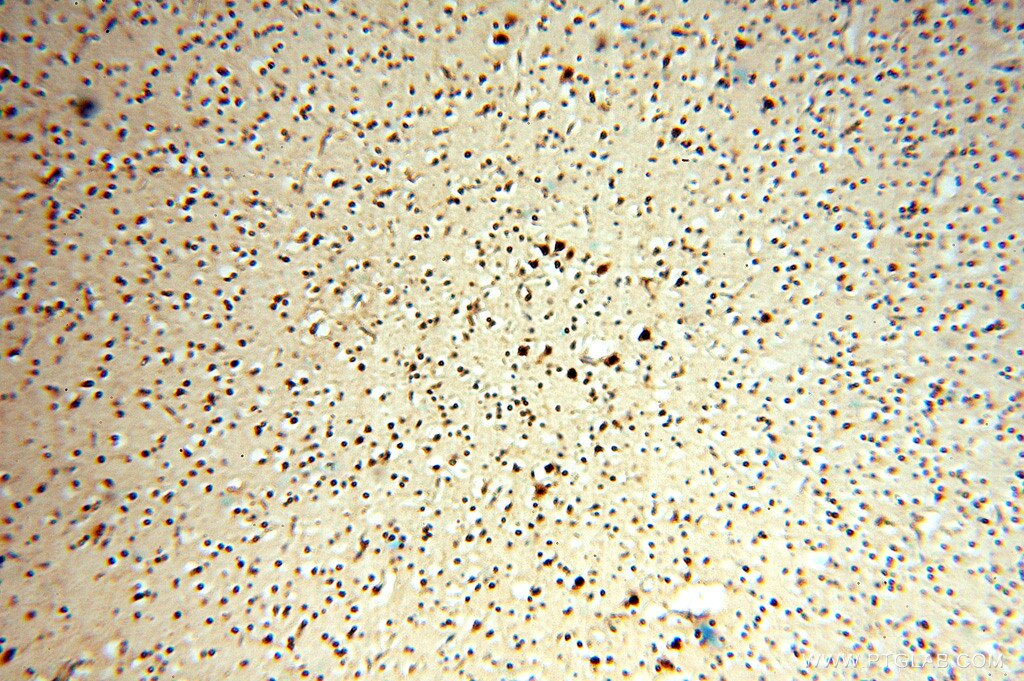 Immunohistochemistry (IHC) staining of human brain tissue using NFS1 Polyclonal antibody (15370-1-AP)
