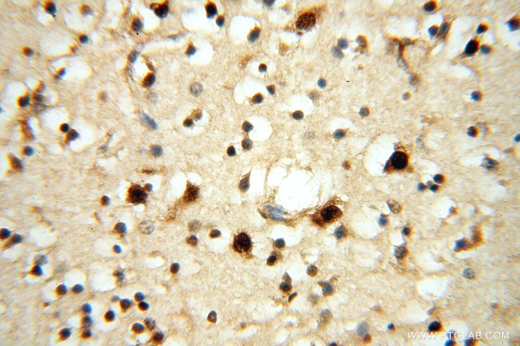 IHC staining of human brain using 15370-1-AP