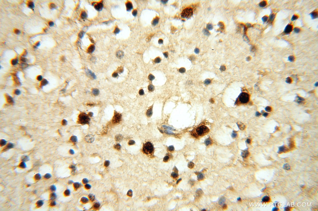 Immunohistochemistry (IHC) staining of human brain tissue using NFS1 Polyclonal antibody (15370-1-AP)