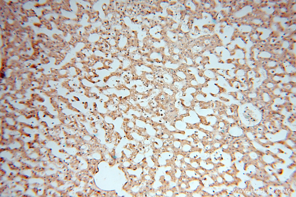 Immunohistochemistry (IHC) staining of human liver tissue using NFS1 Polyclonal antibody (15370-1-AP)