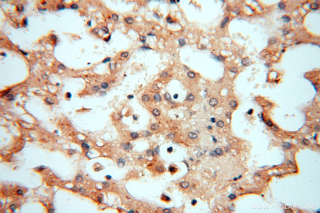 Immunohistochemistry (IHC) staining of human liver tissue using NFS1 Polyclonal antibody (15370-1-AP)