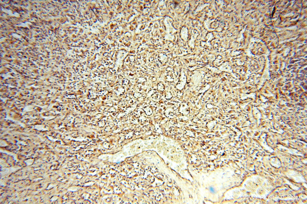Immunohistochemistry (IHC) staining of human spleen tissue using NFS1 Polyclonal antibody (15370-1-AP)