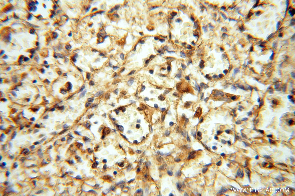 Immunohistochemistry (IHC) staining of human spleen tissue using NFS1 Polyclonal antibody (15370-1-AP)