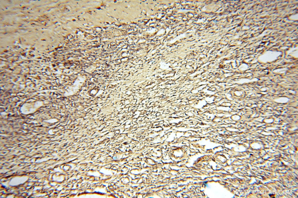 Immunohistochemistry (IHC) staining of human ovary tissue using NFS1 Polyclonal antibody (15370-1-AP)