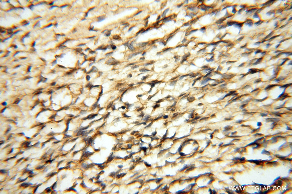 Immunohistochemistry (IHC) staining of human ovary tissue using NFS1 Polyclonal antibody (15370-1-AP)