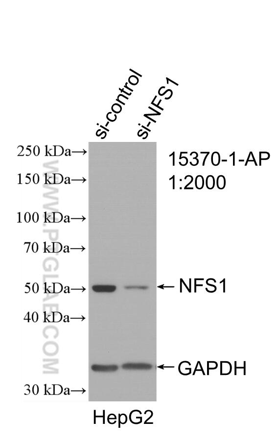Western Blot (WB) analysis of HepG2 cells using NFS1 Polyclonal antibody (15370-1-AP)