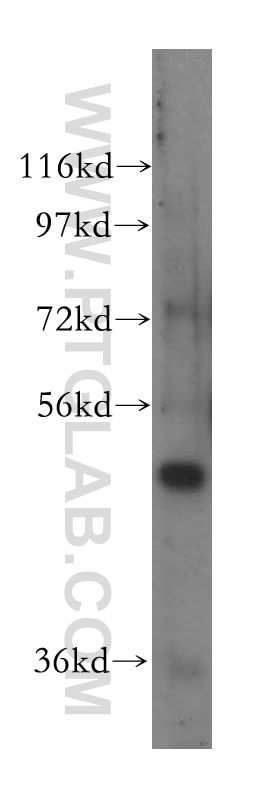 Western Blot (WB) analysis of HepG2 cells using NFS1 Polyclonal antibody (15370-1-AP)