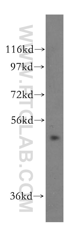 Western Blot (WB) analysis of HeLa cells using NFS1 Polyclonal antibody (15370-1-AP)
