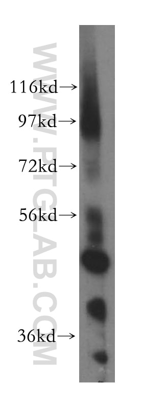 Western Blot (WB) analysis of human heart tissue using NFS1 Polyclonal antibody (15370-1-AP)